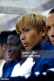 24,172 Club Foot Stock Photos, High-Res Pictures, and Images