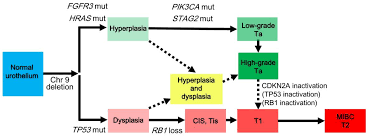 Cancers Free Full Text Bladder Cancer New Insights Into Its Molecular Pathology Html