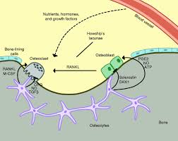 Bone remodeling, in brief, is the process by which osteoclasts eat old bone and stimulate when you get a long bone fracture, bone remodeling kicks in to literally remodel the callus and lay down new. Bone Remodeling In The Context Of Cellular And Systemic Regulation The Role Of Osteocytes And The Nervous System In Journal Of Molecular Endocrinology Volume 55 Issue 2 2015