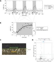 Functional Ultrasound Imaging Reveals Activation Properties of Clinical  Spinal Cord Stimulation Therapy Stimulation Programming