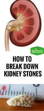 How To Break Down Kidney Stones And Kill Bladder Infection With This One Ingredient Juice Howtobreakdownkidney Kidney Stones Bladder Fitness Healthy Lifestyle