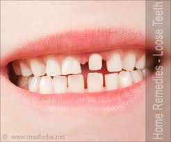 The loose teeth will be stabilised via tooth splinting if required. Home Remedies For Loose Teeth
