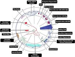 Diagram Of Fundus Wiring Diagram General Helper