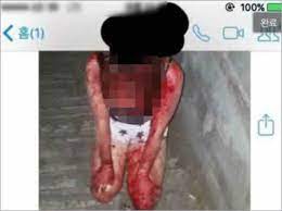 韓国の女子中学生が後輩を壮絶リンチ、血まみれに…… 被害少女「2カ月前にも暴行されていた」 (2017年9月5日) - エキサイトニュース