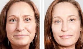 как сузить расширенные поры на лице в домашних условиях How To Look Younger With Simple Face Firming Exercises Face Yoga Exercises Facial Toning Natural Face Lift