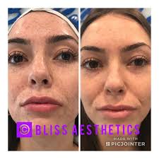 North hollywood on riverside drive, very close off the vineland exit of the . Bliss Aesthetics Med Spa Home Facebook