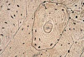 In long bones, as you move from the outer cortical compact bone to the inner medullary cavity, the bone transitions to spongy bone. Compact Bone