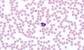 Image result for Platelet Count