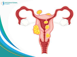 الالتهابات والعدوى قبل الولادة - الالتهابات والحمل وتأثيرها على الجنين -  International Clinics