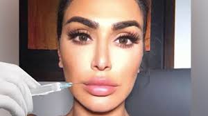 Beauty blogger details her horrific experiences with lip filler