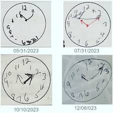 Image result for Clock Drawing Test