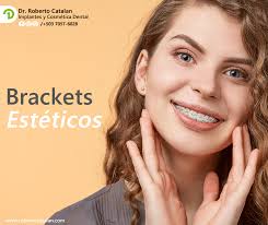 Implantes y Cosmética Dental, Dr. Roberto Catalan