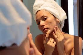 However, most scars are permanent, so is there a way to make it go away? Will Acne Scars Go Away 10 Acne Treatment Solutions Apotheco Pharmacy