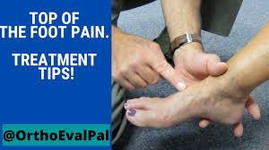 The occurrence of a bone spur is due to the body's natural mechanism to build an extra bone in an area the patient may be asked to do some exercises shown by a healthcare professional. Top Of The Foot Pain Treatment Tips Youtube