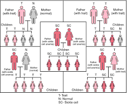 Sickle cell anemia, also called sickle cell disease (ss disease), is an inherited condition caused by having abnormal hemoglobin, the protein that carries oxygen in the blood. Sickle Cell Disease Definition Of Sickle Cell Disease By Medical Dictionary
