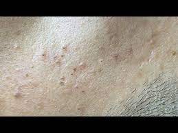 Thuy Truong Sac Dep Spa Youtube In 2021 Spa The Creator Celestial Bodies