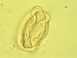 Image result for Leptaulus