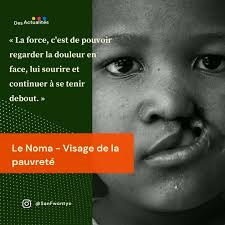 𝗦𝗮𝗻𝗙𝘄𝗼𝗻𝘁𝘆𝗲 ✍︎ (@_san_fwontye_) · Instagram 照片和视频