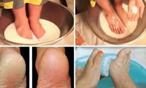 Apprenez A Soigner Les Pieds Secs Fendilles Et Pleins De Callosites A La Maison Pied Sec Soin Des Pieds Soins Des Pieds