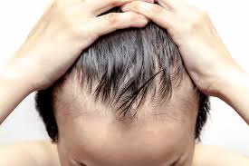 To have healthy hair for a long time, you must bear in mind these healthy hair tips for women. 15 Healthy Hair Tips For Men