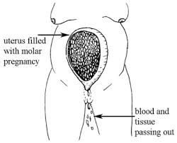 Is it normal to have spotting at 8 weeks pregnant? Antenatal Care Module 10 Estimating Gestational Age From Fundal Height Measurement View As Single Page