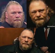 Fans are concerned about the sudden change in Brock Lesnar's face in just  one month after Wrestlepalooza, as seen in the new WrestleMania 42 promo.