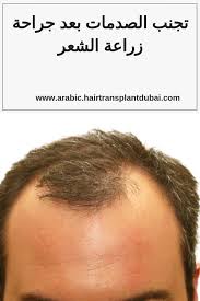 تجنب الصدمات بعد جراحة زراعة الشعر زراعة شعر في دبي Hair Transplant Transplant Dubai