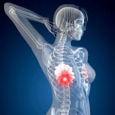 If prostate cancer has spread to your bones, you'll likely need medication to ease your pain, lower the risk of fractures, and keep your body's calcium levels steady. Breast Cancer Signs Symptoms Causes Treatment Stages Survival Rates