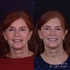 😍 Vamos a planear tu nueva sonrisa! Nos encanta platicar, escucharte,  saber cuáles son tus expectativas y así crear una sonrisa perfecta! 😁✨ .  Citas al WhatsApp 💬 871 404 3344 📍Torreón,