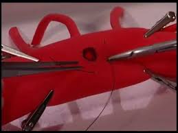 Image result for Purse String Suture