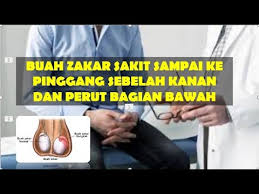 Siapa yang pernah mengalami kebanyakan sakit pinggang sebelah kanan disebabkan oleh kebiasaan mengangkat beban berat sebenarnya pankreas dan hati terletak di daerah perut sebelah kanan, tepat di bawah tulang rusuk. Buah Zakar Sakit Sampai Ke Pinggang Sebelah Kanan Dan Perut Bagian Bawah Youtube