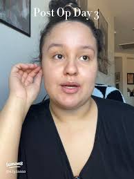 Jon's Inspiring Post-Surgery Journey Updates