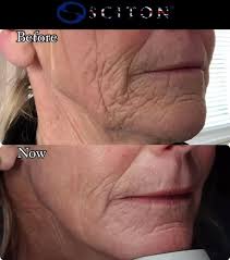 It's hard to believe six months have already passed! When I first met this… 