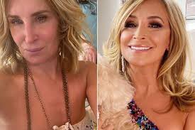 Sonja Morgan Reveals She Got a Lower Face Lift and Neck Lift