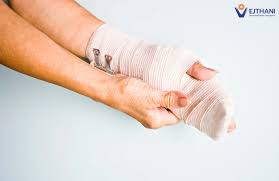 Image result for Hand Injury