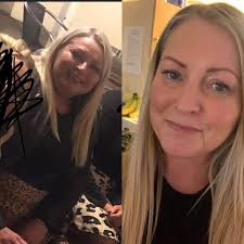 The first place you can see weight loss in the face and neck. This noise of  any weight loss