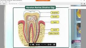 Ni saya sajikan gigi pesakit saya baru 3 tahun gigi dah semuanya rosak!!! Sains Tahun 3 Manusia Jenis Gigi Dan Kerat Rentas Gigi Youtube