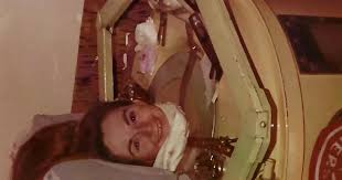 O paciente, que viveu ligado a um ventilador mecânico por 70 anos, morreu porque o aparelho era muito antigo.