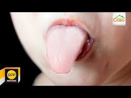 Por Que Tu Hijo Puede Tener La Lengua Blanca Rpp Youtube