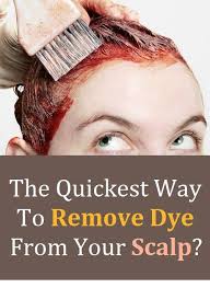 Treat your scalp like a regular burn. Pin On Beauty