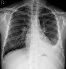 You can use this swimming information to make your own swimming trivia questions. Test Yourself Chest X Ray Quiz 1