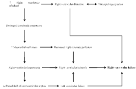Image result for Right Heart Failure