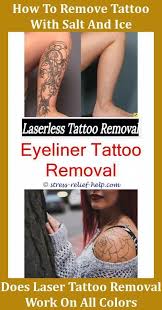 Tattoo Excision What Is Tattoo Removal Like Custom Temporary Tattoos Is Removing Tattoos At Home Saf Eyebrow Tattoo Removal Tattoo Removal Laser Tattoo Removal