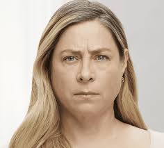 Anti Ageing Injections