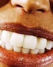 Nyu college of dentistry's rodrigo lacruz explains how exposing teeth to excessive fluoride alters calcium signaling, mitochondrial function, and gene expression in the cells forming tooth enamel. How Fluoride Firms Up Teeth Nature