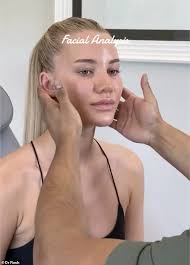 Love Island's Grace Jackson pre-villa makeover REVEALED: Blonde bombshell  underwent lip, chin and tear trough filler before the show