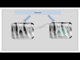 Image result for Coin Test