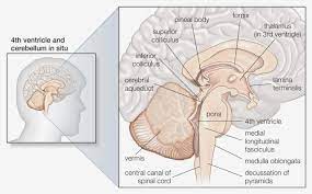 What To Expect From A Stroke Of The Medulla Oblongata Anatomy Nervous System Anatomy Cognitive Activities