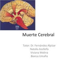 La herencia del dualismo cartesiano lleva a buscar el momento de separación del alma y el cuerpo como si fueran. Ppt Muerte Cerebral Powerpoint Presentation Free Download Id 3164284