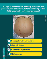 Image result for Fluid Wave Test